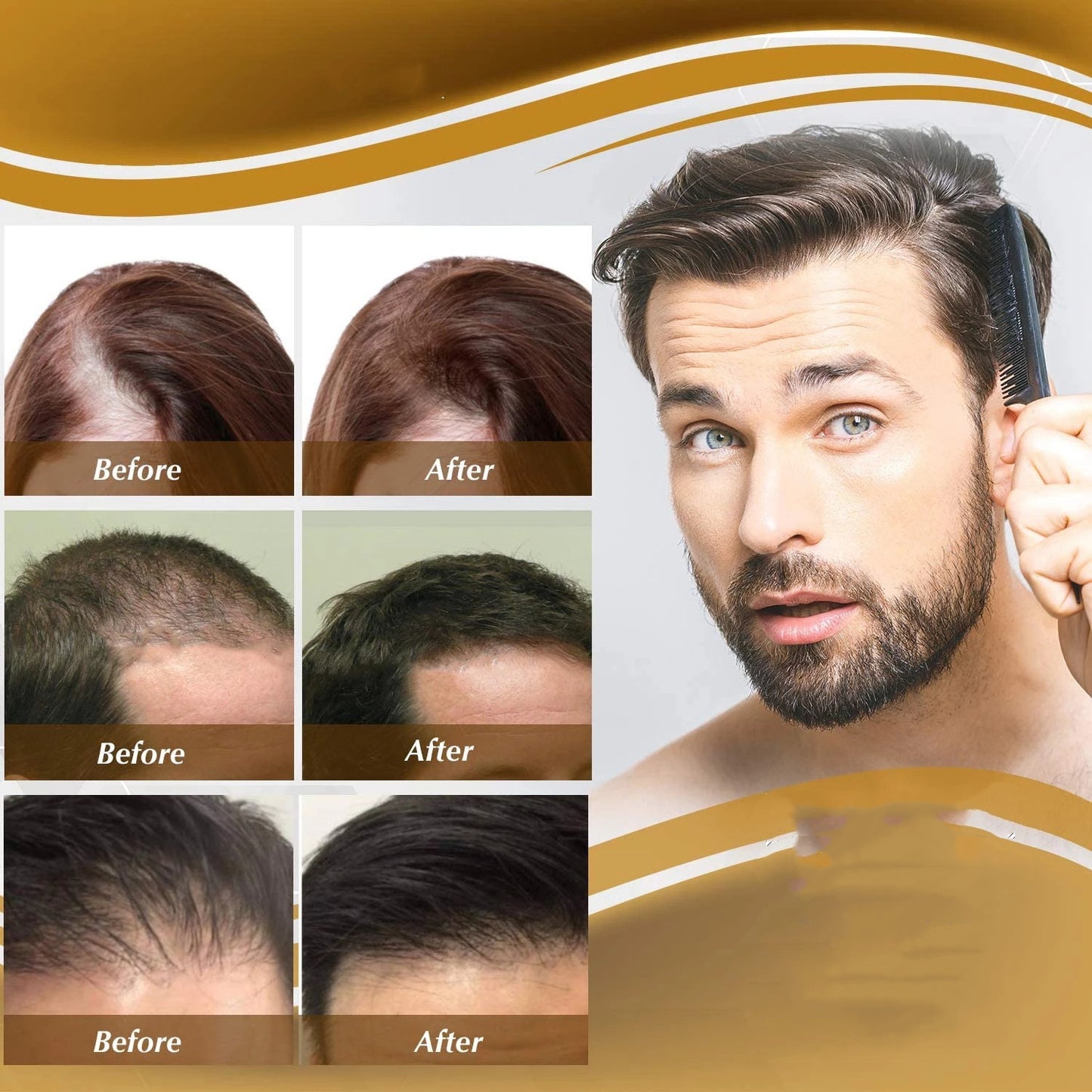 Anti queda de cabelo, líquido nutritivo para cabelos, firmador e crescimento capilar