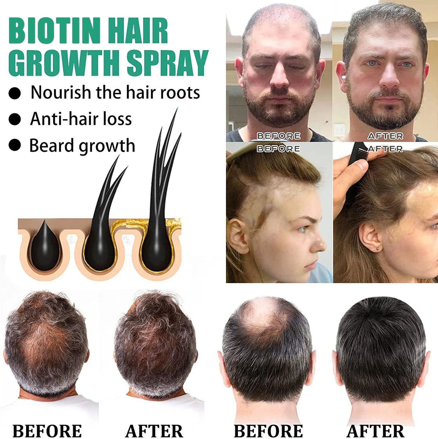 Anti queda de cabelo, líquido nutritivo para cabelos, firmador e crescimento capilar